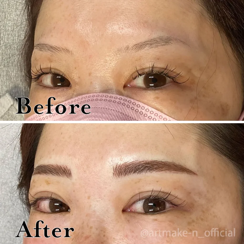 長崎 眉アートメイク 4D 症例 ビフォーアフター 30代女性