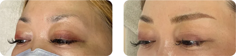 長崎 眉アートメイク 4D 症例 ビフォーアフター 40代女性